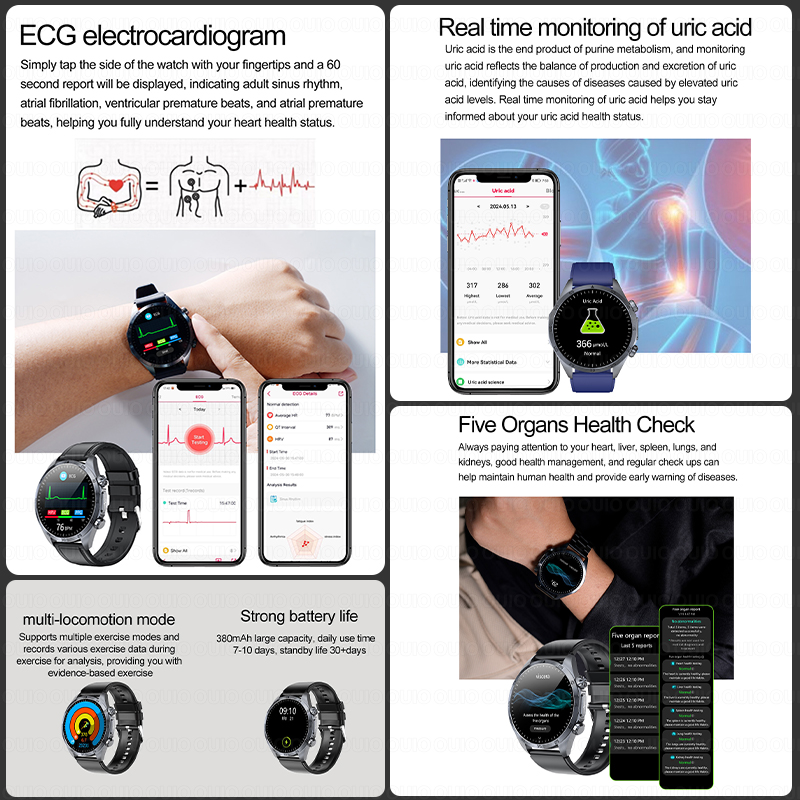 Nouvelle montre connectée 2026 - Smartwatch Branded Watches For Women avis et prix